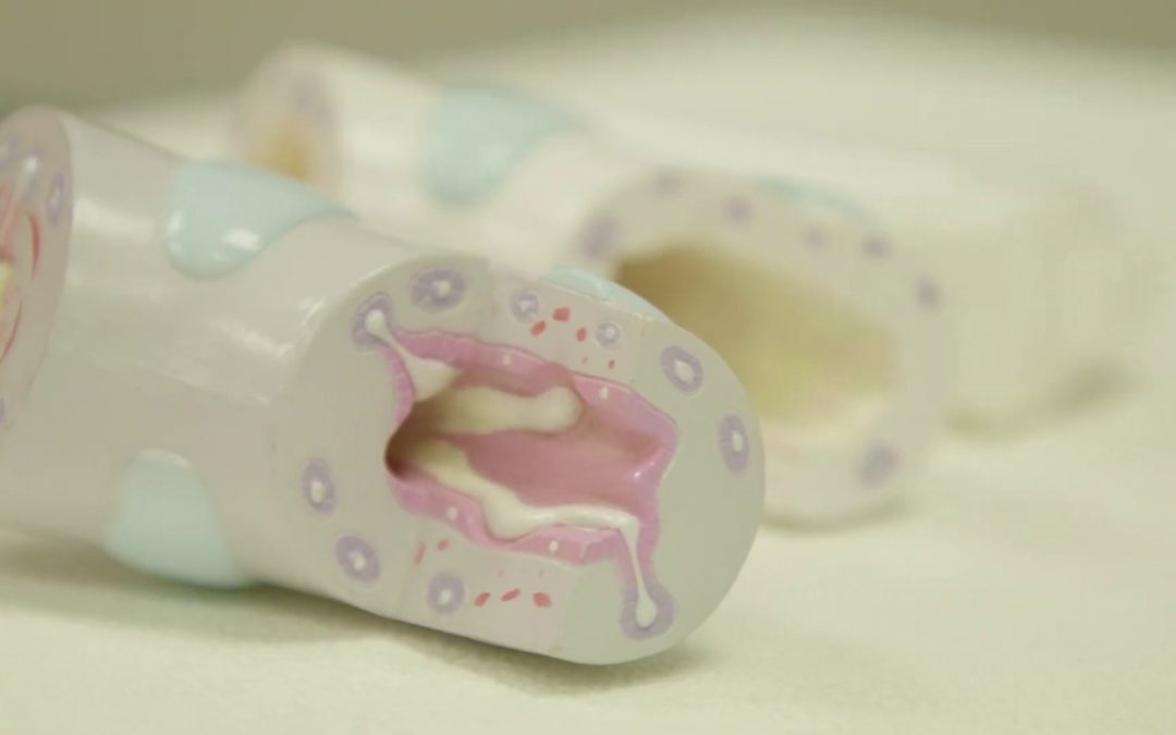 Asthma: Does Your Child Have It?